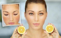 Goodbye to Dark Spots: A Natural Solution with Lemon Juice